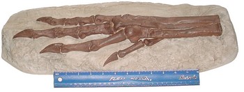 chirostenotes foot cast